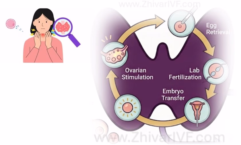 تیروئید و ivf